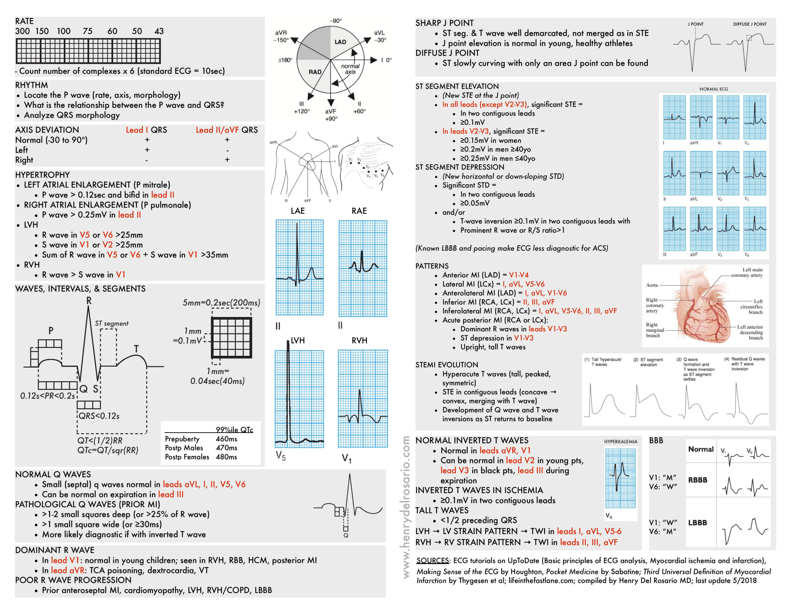 Ecg Cheat Sheet Ecg Rapid View: It Is Organized | Grepmed within Free Printable Ekg Interpretation Cheat Sheet