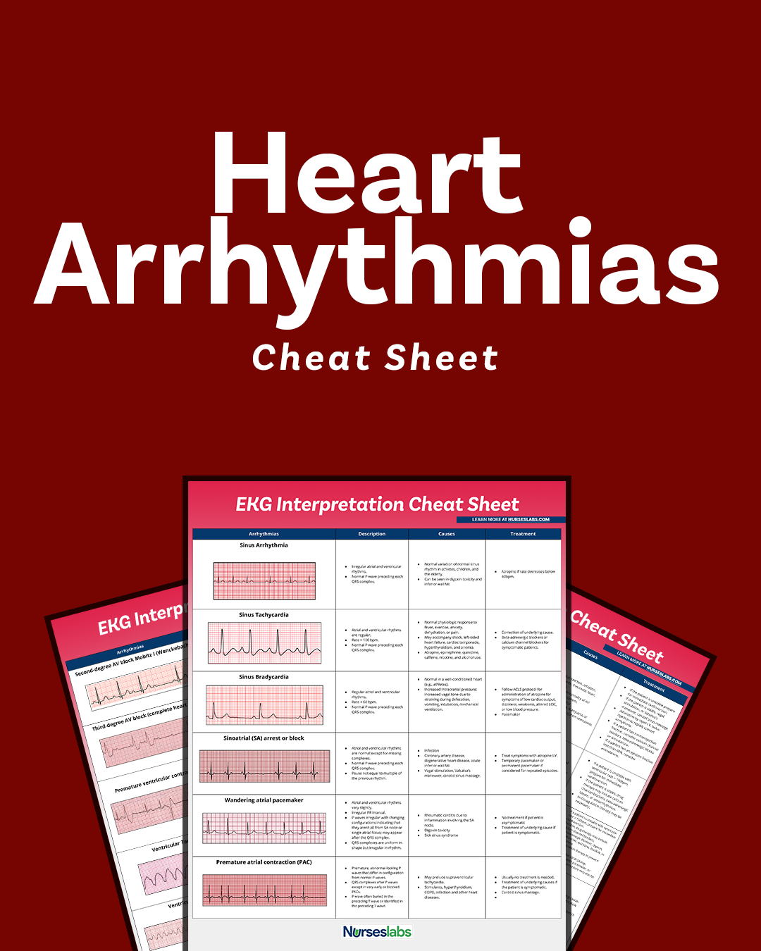 Ekg Interpretation Cheat Sheet &amp;amp; Heart Arrhythmias Guide (2020 Update) inside Free Printable Ekg Interpretation Cheat Sheet