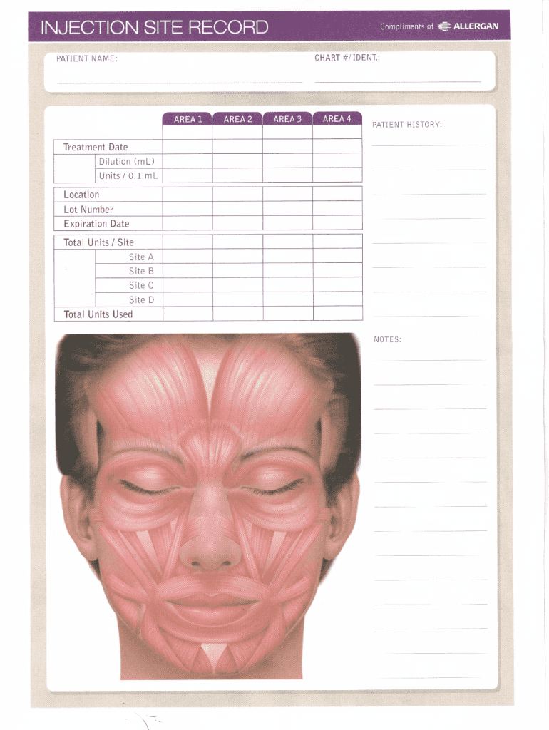 Free Printable Botox Face Chart: Fill Out &amp;amp; Sign Online | Dochub regarding Free Printable Botox Face Chart