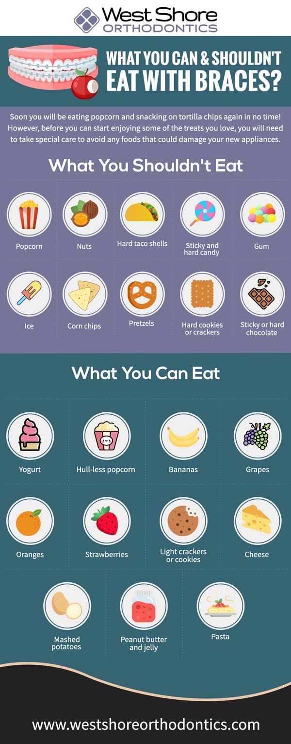 What You Can And Shouldn&amp;#039;T Eat With Braces? [Infographic] with Printable List of Foods to Avoid With Braces